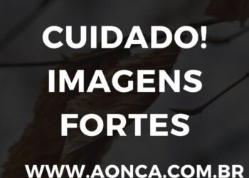 Dona de creche batia e dopava bebê de 11 meses e “atentou contra própria vida” usando aparelho dentário após ser presa