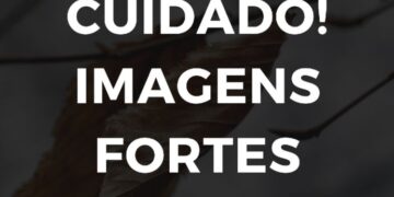 Dona de creche batia e dopava bebê de 11 meses e “atentou contra própria vida” usando aparelho dentário após ser presa