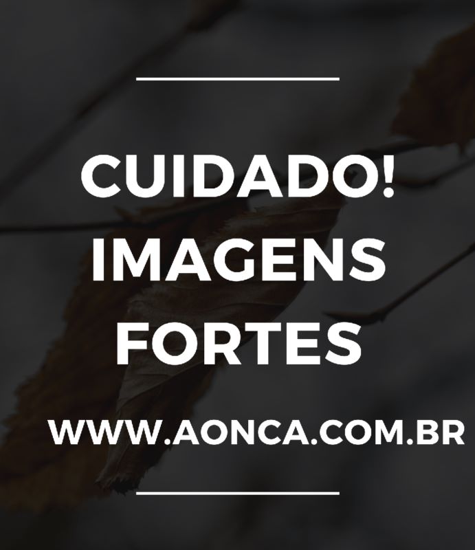 Dona de creche batia e dopava bebê de 11 meses e “atentou contra própria vida” usando aparelho dentário após ser presa