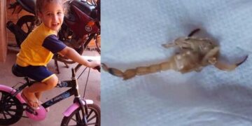 2⁰ caso em Ribas: menina de 3 anos m*rre após picada de escorpião