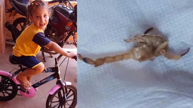 2⁰ caso em Ribas: menina de 3 anos m*rre após picada de escorpião