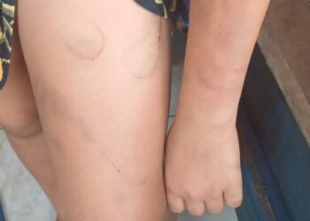 Padrasto é preso em flagrante por agredir e ameaçar enteada autista