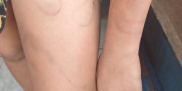 Padrasto é preso em flagrante por agredir e ameaçar enteada autista