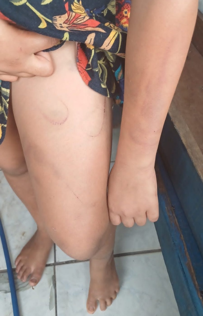 Padrasto é preso em flagrante por agredir e ameaçar enteada autista