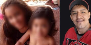 Vítima de incêndio do ex-namorado da mãe, menina de 11 anos teve braço, perna e dedos amputados