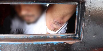 Dourados: infecção generalizada de sarna em presídio estadual preocupa Defensoria Pública