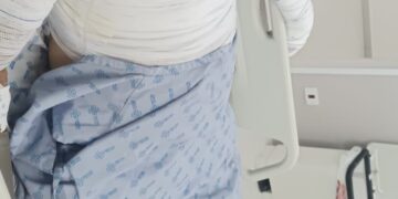 Seu Durval teve 60% do corpo queimado e perdeu tudo após bujão explodir; veja como ajudar 