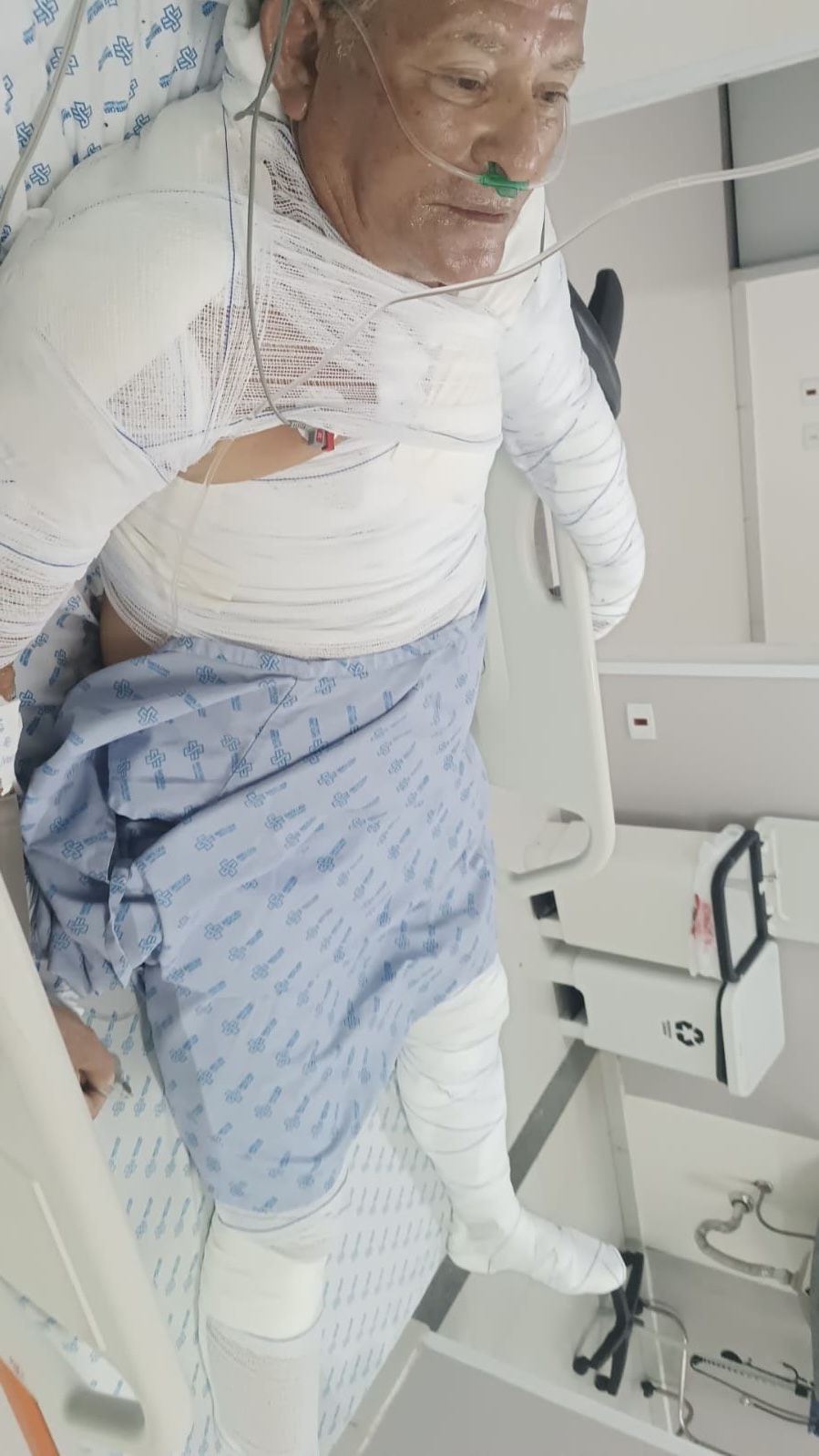 Seu Durval teve 60% do corpo queimado e perdeu tudo após bujão explodir; veja como ajudar 