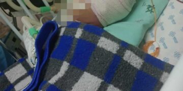 Genitora e padrasto de menino de 2 anos em coma são presos pela DEPCA 