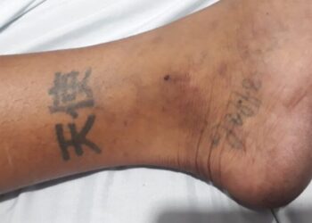 Dourados: Hospital pede ajuda para identificar paciente espancado