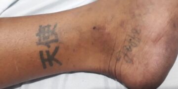 Dourados: Hospital pede ajuda para identificar paciente espancado