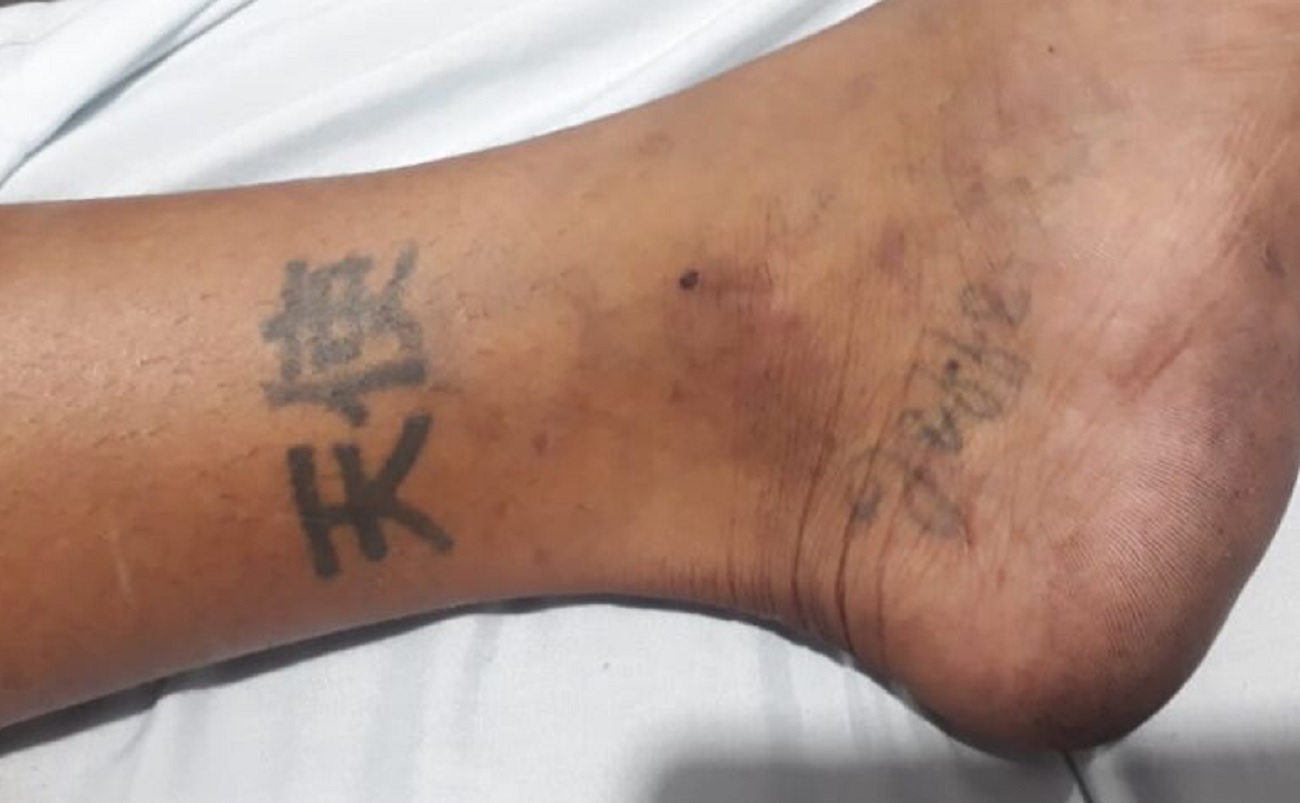 Dourados: Hospital pede ajuda para identificar paciente espancado