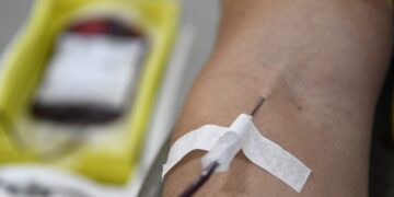 Com estoque crítico para os tipos O negativo e positivo, Hemosul convoca doadores de sangue