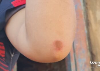 Tiroteio que vitimou dois adolescentes por engano deixou mais uma pessoa ferida 