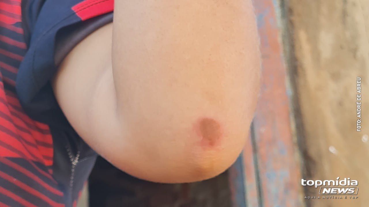 Tiroteio que vitimou dois adolescentes por engano deixou mais uma pessoa ferida 