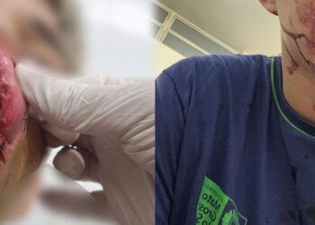 Vídeo: adolescente é agredido com um soco na boca em escola da Capital 
