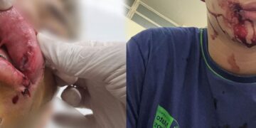 Vídeo: adolescente é agredido com um soco na boca em escola da Capital 