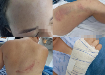 Vídeo: em relato angustiante, mulher conta como sobreviveu a atentado em São Gabriel onde amiga morreu