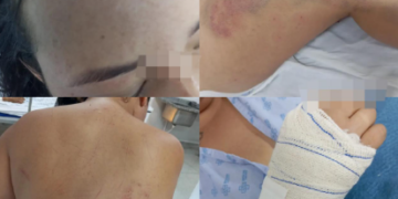 Vídeo: em relato angustiante, mulher conta como sobreviveu a atentado em São Gabriel onde amiga morreu