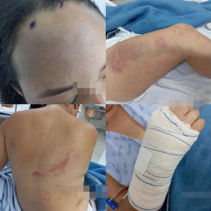 Vídeo: em relato angustiante, mulher conta como sobreviveu a atentado em São Gabriel onde amiga morreu