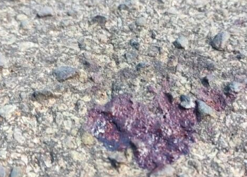 Homem pede socorro em UPA com as vísceras expostas após esfaqueamento nas Moreninhas