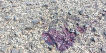 Homem pede socorro em UPA com as vísceras expostas após esfaqueamento nas Moreninhas