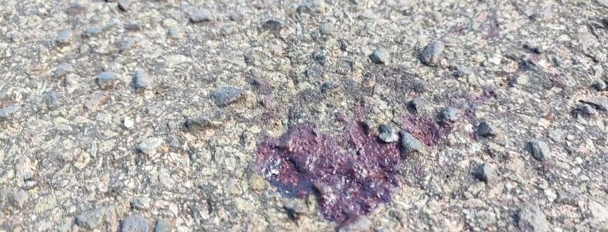 Homem pede socorro em UPA com as vísceras expostas após esfaqueamento nas Moreninhas