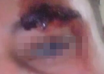 Jovem é espancado por seguranças de boate onde trabalhava