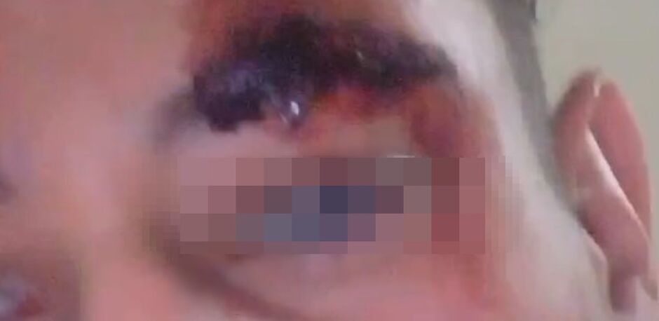 Jovem é espancado por seguranças de boate onde trabalhava