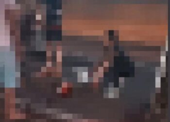 Vídeo: Motociclista tem perna arrancada em acidente na Capital; imagens são fortes 