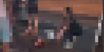 Vídeo: Motociclista tem perna arrancada em acidente na Capital; imagens são fortes 