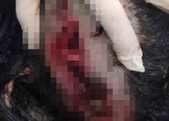 Homem pede prato de comida, esfaqueia moradora e soca boca de criança em MS