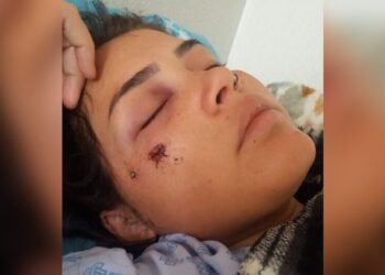 Atingida com tiro no rosto e passando por gravidez de risco, jovem aguarda cirurgia na Santa Casa