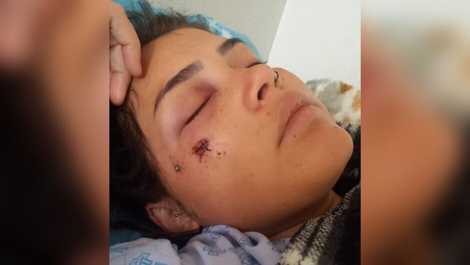 Atingida com tiro no rosto e passando por gravidez de risco, jovem aguarda cirurgia na Santa Casa