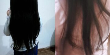“Tá faltando pedaço do meu cabelo de princesa”: criança com autismo tem cabelos cortados creche 