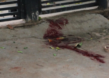 Jovem foi baleado no rosto por dois motociclistas no Jardim Campo Alto