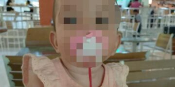 Bebê vítima de tentativa de afogamento precisa de doações de sangue; genitora segue presa