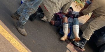 Trabalhador sofre fratura exposta ao colidir moto com caminhão