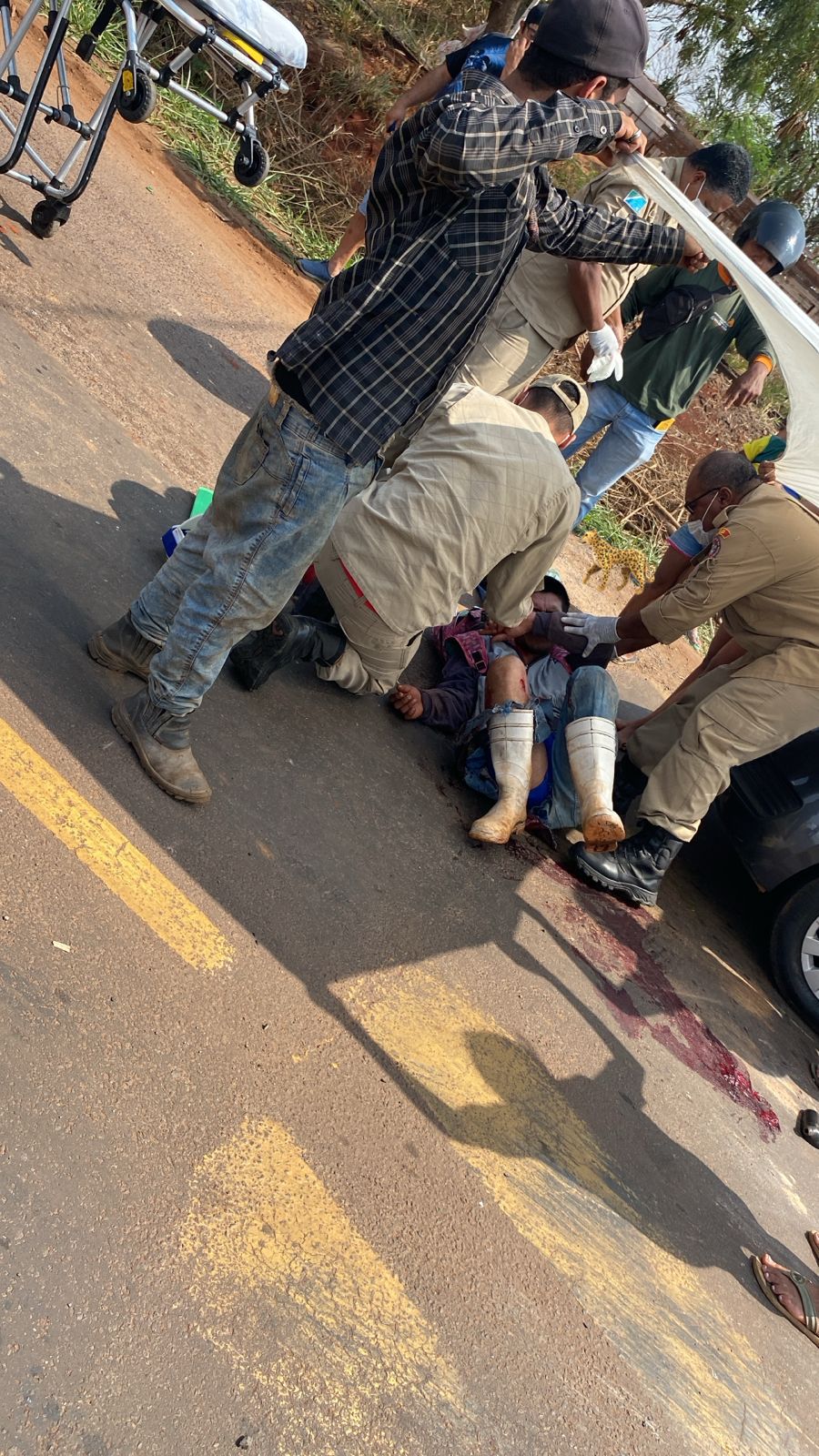 Trabalhador sofre fratura exposta ao colidir moto com caminhão