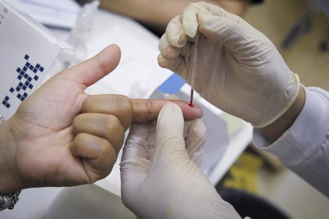 Sesau faz alerta para aumento de casos de Hepatite A em Campo Grande