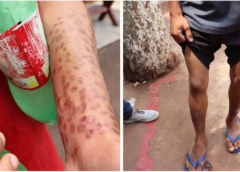 Comunidade Terapêutica é interditada e internos são encontrados dopados e com marcas de agressões 