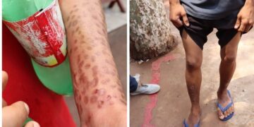 Comunidade Terapêutica é interditada e internos são encontrados dopados e com marcas de agressões 