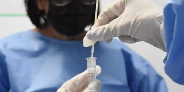 Fiocruz aponta sinais de queda em alta recente da covid-19 no país