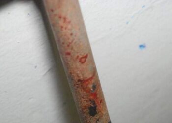 Homem espancado com barra de ferro em Dourados está em estado gravíssimo