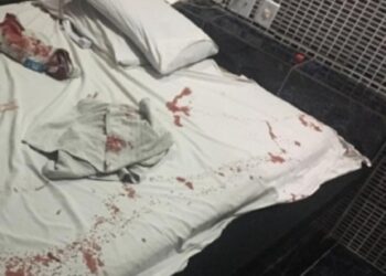 Mulher invade motel e esfaqueia marido em Iguatemi; ferimento foi gravíssimo