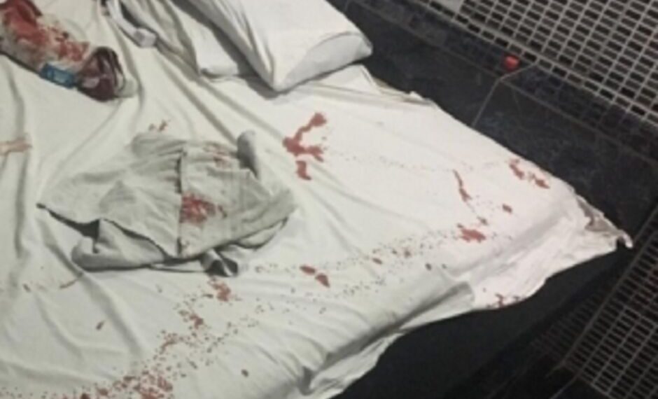 Mulher invade motel e esfaqueia marido em Iguatemi; ferimento foi gravíssimo