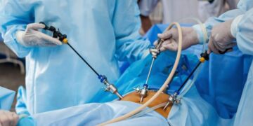 SES amplia acesso à cirurgia bariátrica em MS com triagem criteriosa e novas referências