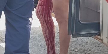 Vídeo: Homem leva facada ao defender passageira em ônibus na Capital 