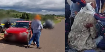 Idoso de 81 anos sofre grave acidente ao ser stropelado na BR-419 em Aquidauana