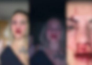 Músico quebra nariz de jornalista que estava com bebê no colo e mesmo assim é solto pela justiça